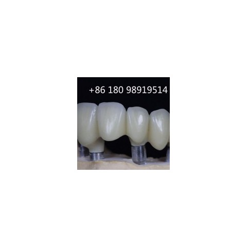 China Dental Lab, Dental Lab China, China Outsourcing Dental Lab图2