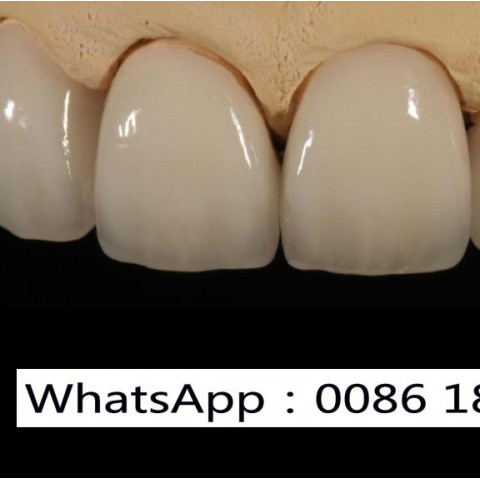 America Dental Lab, Dental Lab America, America Outsourcing Dental Lab图3